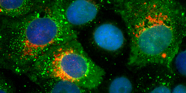 Células infectadas con SARS-CoV2 (en verde, anticuerpo anti-nucleocapside del virus), teñidas con anticuerpo W25 anti-proteína Spike S1 SARS-CoV2 (en rojo, FluoTag-Q anti-SARS-CoV-2 Spike protein S1 SC3). El núcleo se observa en azul (tinción DAPI).